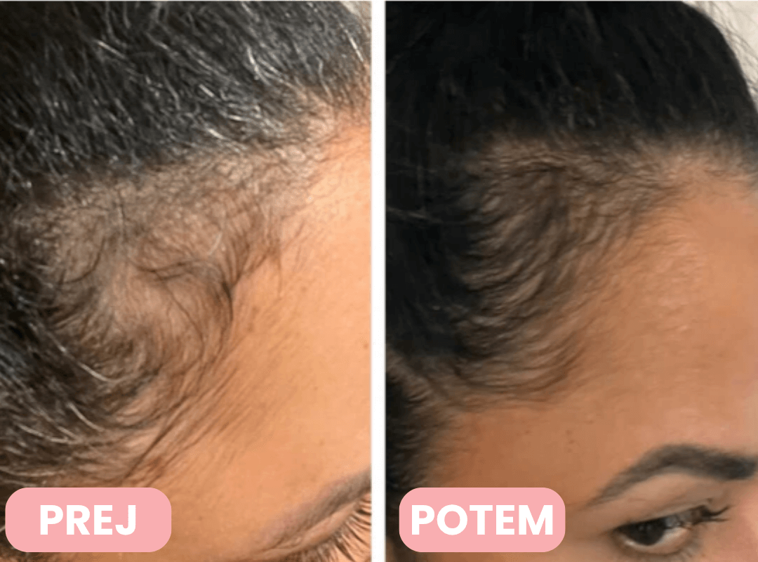 Derma Brush