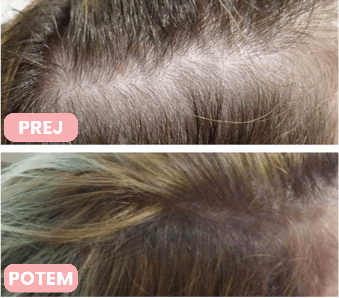 Derma Brush