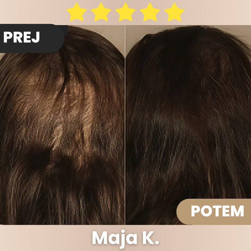 Moji lasje so se popolnoma spremenili ❤️