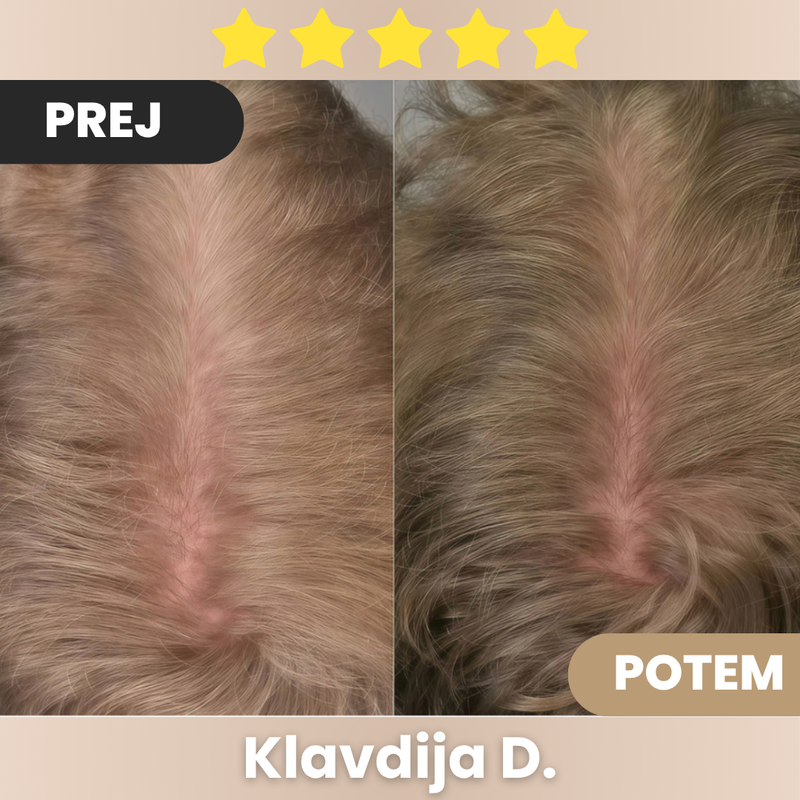 Impresiven rezultat že po prvi uporabi!